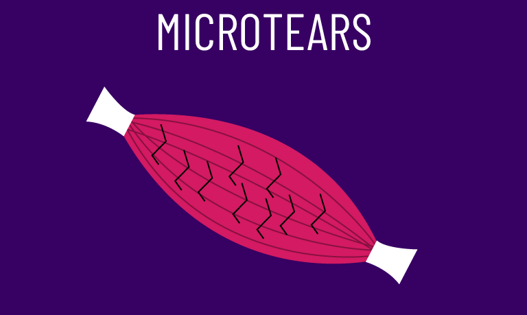 do-microtears-in-the-muscle-cause-growth-science-analysis-house-of